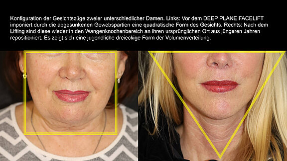 Konfiguration der Gesichtszüge