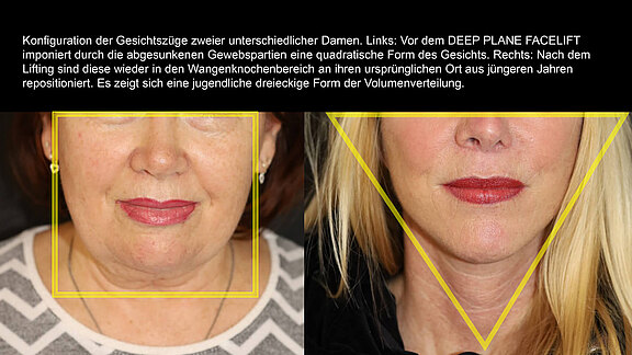 Konfiguration der Gesichtszüge