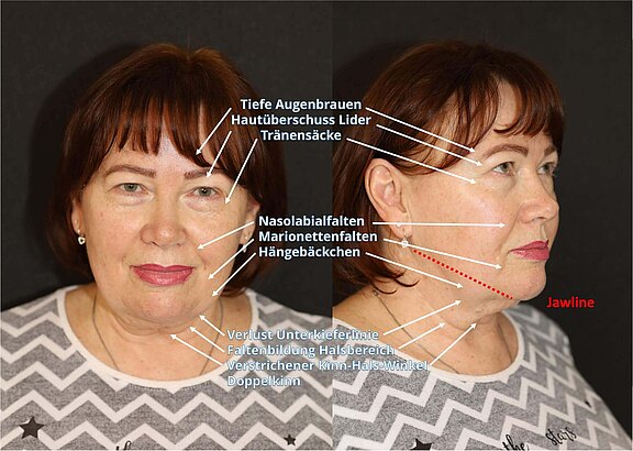 Welche Erscheinungen des Alters können vorliegen